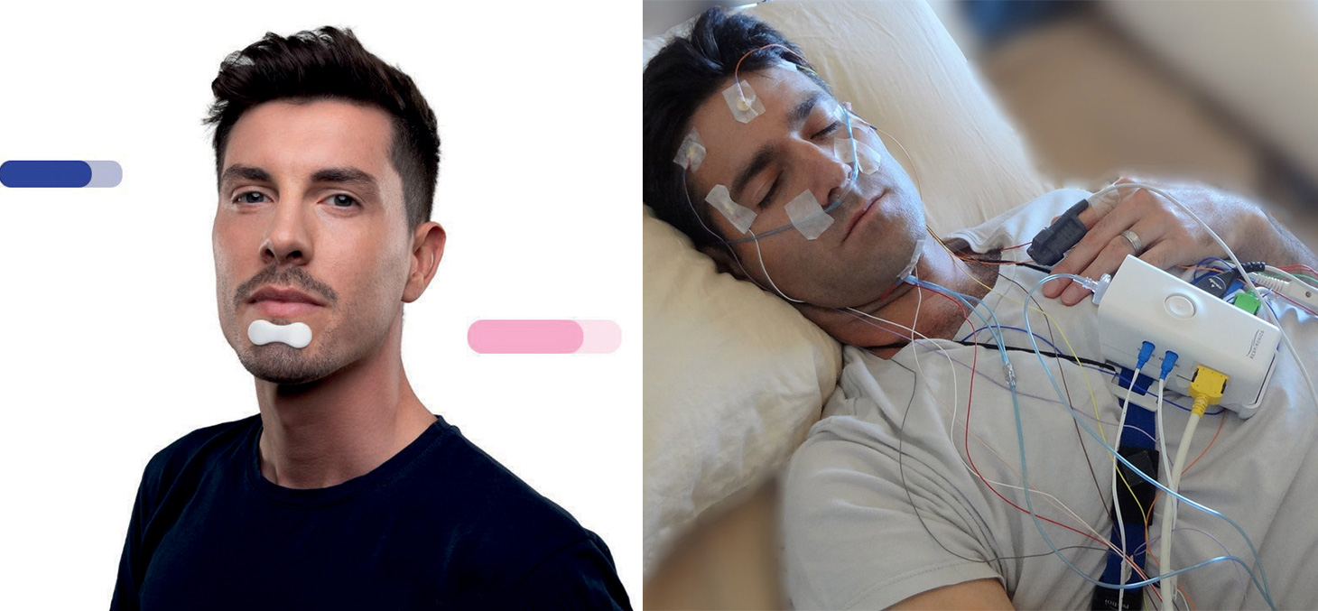 SensApnea